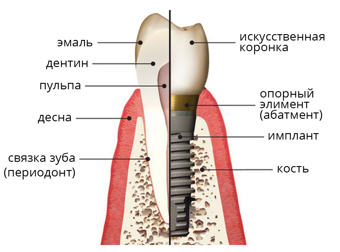 Имплантация зубов, Николаев